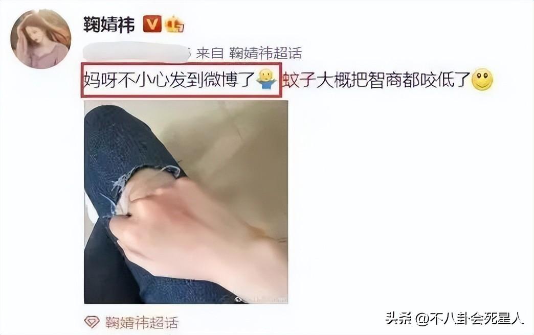 宋伊人脖子上的伤疤__王思聪出席万达集团活动