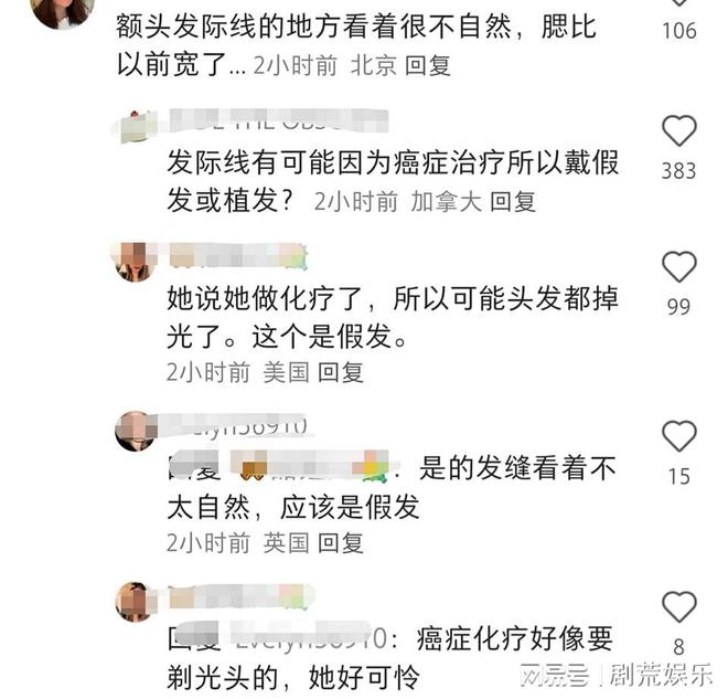 凯特王妃终于现身，检查出癌症面容憔悴，头发被质疑是假的！__凯特王妃终于现身，检查出癌症面容憔悴，头发被质疑是假的！