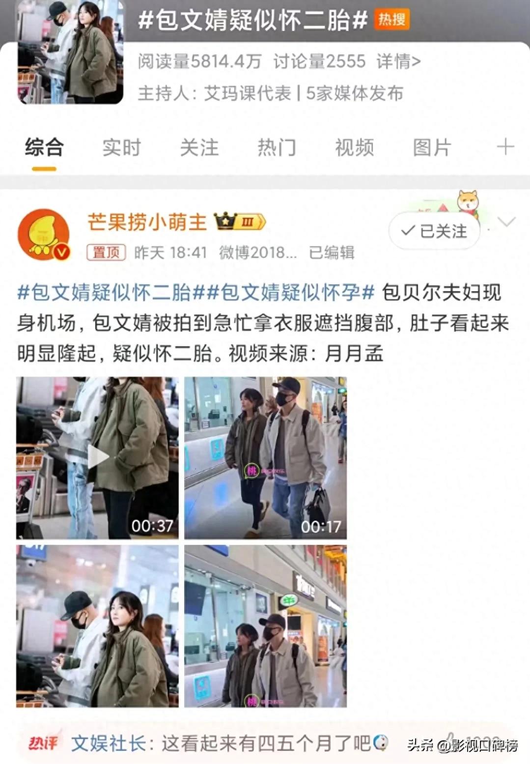 包贝尔长发造型__包贝尔发型叫啥名字