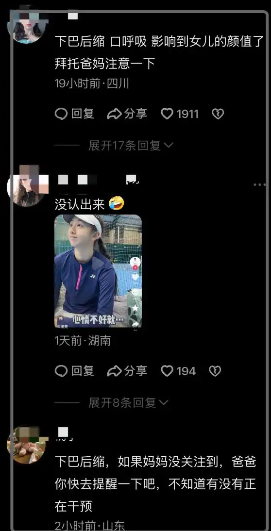 下巴后缩口齿不清_下颌缩进去应该怎么办_医生称森碟下巴后缩或影响口腔功能