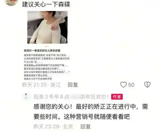 下颌缩进去应该怎么办_下巴后缩口齿不清_医生称森碟下巴后缩或影响口腔功能